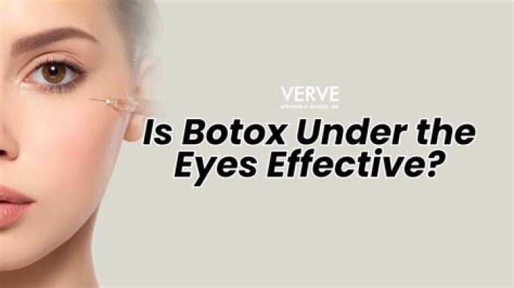 Why is Botox not permanent?
