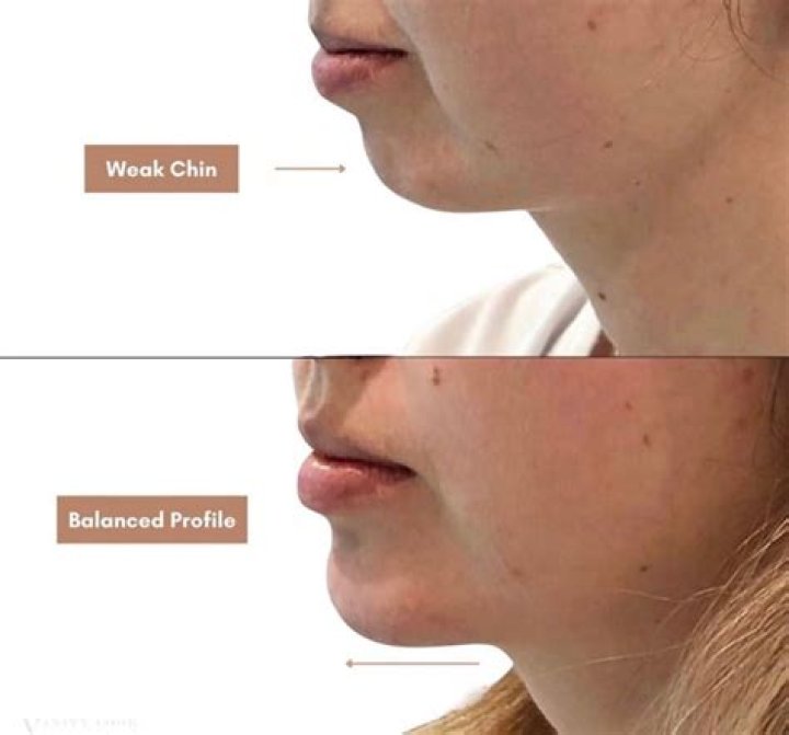 Why is my chin and nose red?