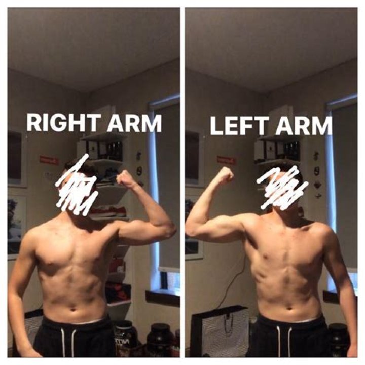 Why is my left arm stronger than my right arm?