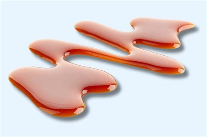 Will syrup stains come out?